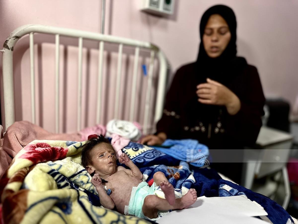 “الصحة العالمية”: 112 طفلا يدخلون مستشفيات غزة يوميا بسبب سوء التغذية