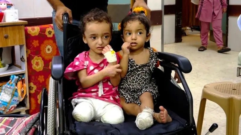 منظمة الصحة العالمية: 15 ألف مبتور أطرافهم في غزة والوضع الصحي ينهار