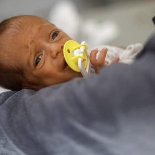 الصحة العالمية: وفاة 421 شخصا بسبب سوء التغذية بغزة في 2025