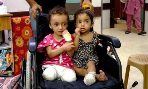 منظمة الصحة العالمية: 15 ألف مبتور أطرافهم في غزة والوضع الصحي ينهار
