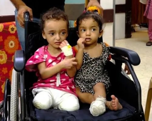 منظمة الصحة العالمية: 15 ألف مبتور أطرافهم في غزة والوضع الصحي ينهار