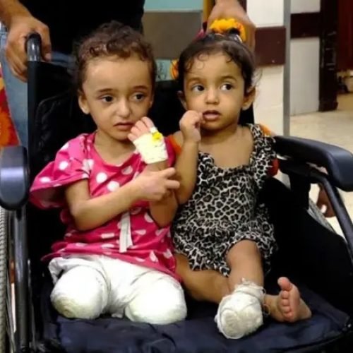 منظمة الصحة العالمية: 15 ألف مبتور أطرافهم في غزة والوضع الصحي ينهار