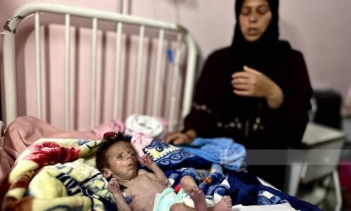“الصحة العالمية”: 112 طفلا يدخلون مستشفيات غزة يوميا بسبب سوء التغذية
