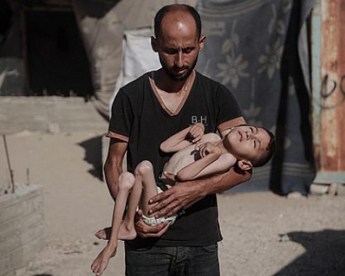 الصحة بغزة: 113 شهيدا و 637 إصابة خلال 24 ساعة